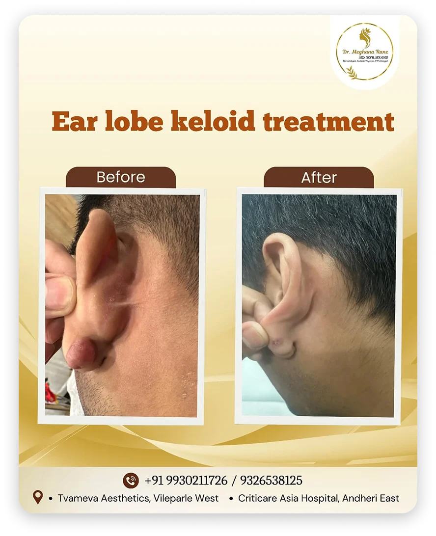 527112256_17984192192841624_8702916927497297381_n 1