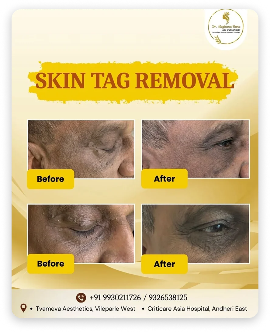 548243815_17988939593841624_1284255590493452484_n 1